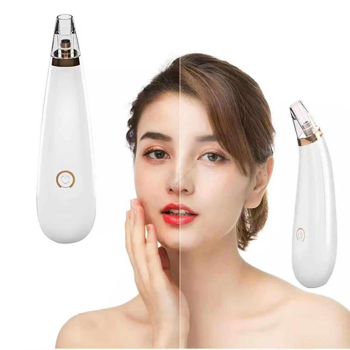 Electric Blackhead Remover Facial Black And White Beauty Hardware Device for Face Care