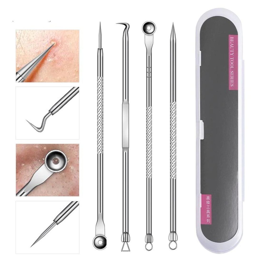 Blackhead Remover, A One 4PCS Stainless Facial Acne Spot Pimple Remover Extractor Tool Comedone Acne Removal Kit (Silver)