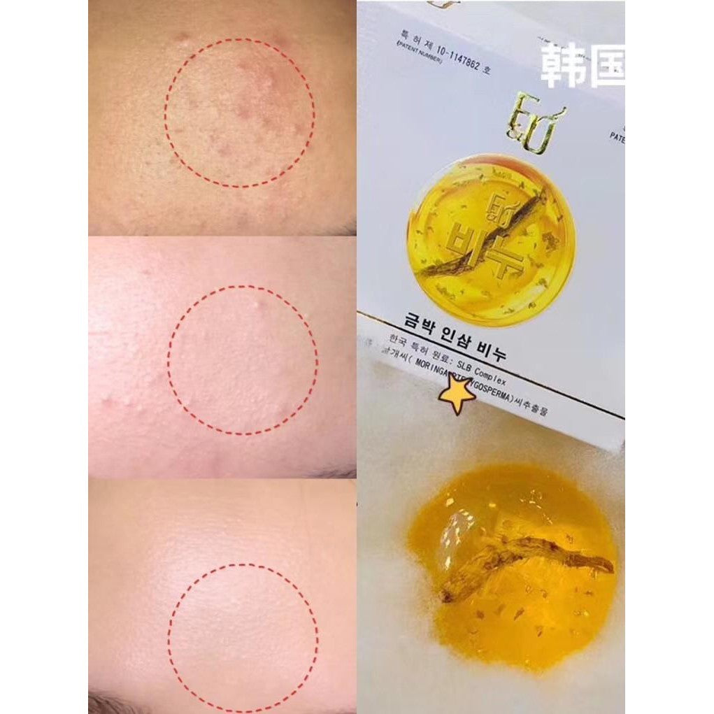 soap Sophora flavescens mite-removing soap wash face sulfur soap facial cleaning female and male mite-removing handmade