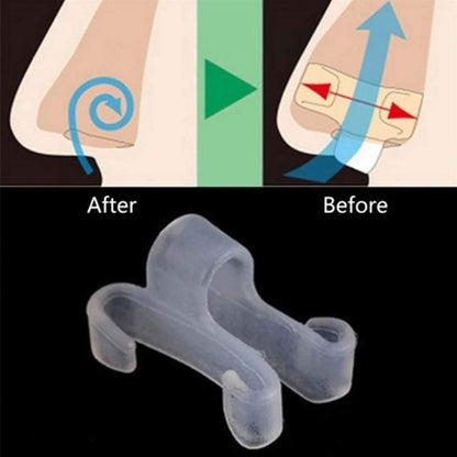 Anti Snoring Nose Clip Sleep Apnea Stop Snoring Device Nasal Dilator Breathing Aid Sleep Care