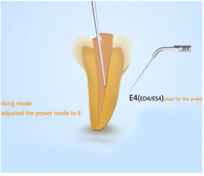 1 Single Pcs Woodpecker E4 Scaler Tip for UDS & EMS Ultrasonic Scalers – Dental Periodontal Scaling Tip