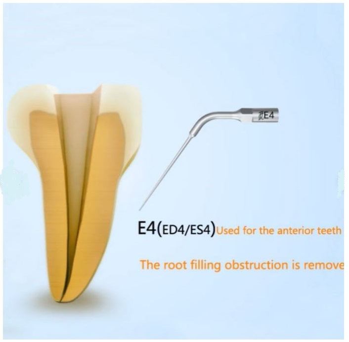 1 Single Pcs Woodpecker E4 Scaler Tip for UDS & EMS Ultrasonic Scalers – Dental Periodontal Scaling Tip