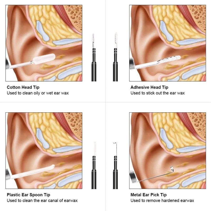 🔍 Endoscope Ear Camera 5.5mm USB Type-C – HD Ear Cleaner &amp; Ear Wax Remover (Box Pack New)  Android Type-C | Otoscope with Light | Waterproof Inspection Camera | 1.5m Cable | 4 Tool Heads