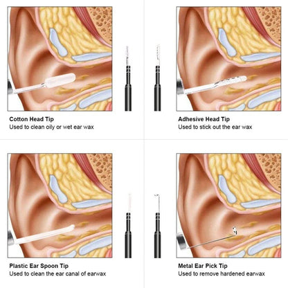 🔍 Endoscope Ear Camera 5.5mm USB Type-C – HD Ear Cleaner &amp; Ear Wax Remover (Box Pack New)  Android Type-C | Otoscope with Light | Waterproof Inspection Camera | 1.5m Cable | 4 Tool Heads