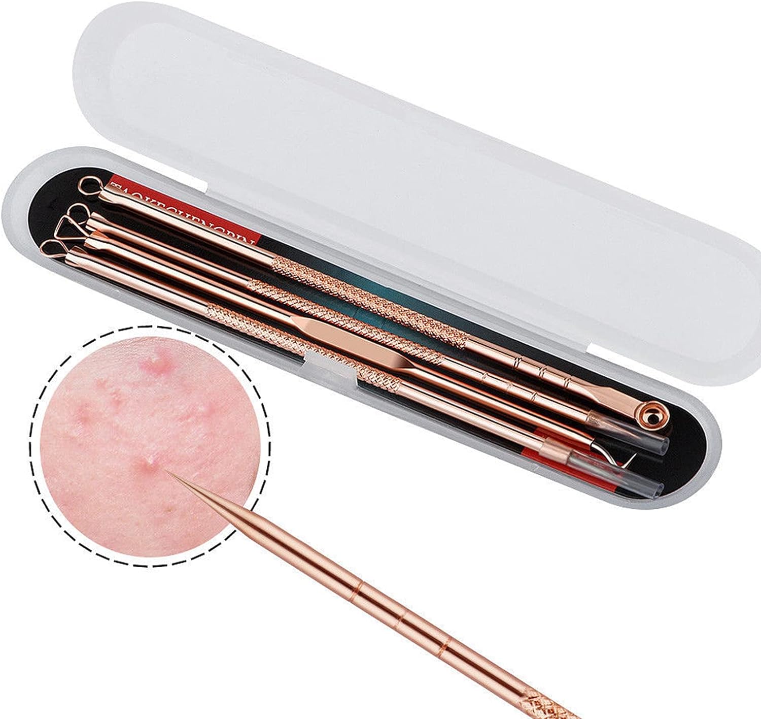 4 Pcs/Set Acne Blackhead Removal Needles Stainless Pimple Spot Comedone Extractor Cleanser Beauty Face Clean Care Tools