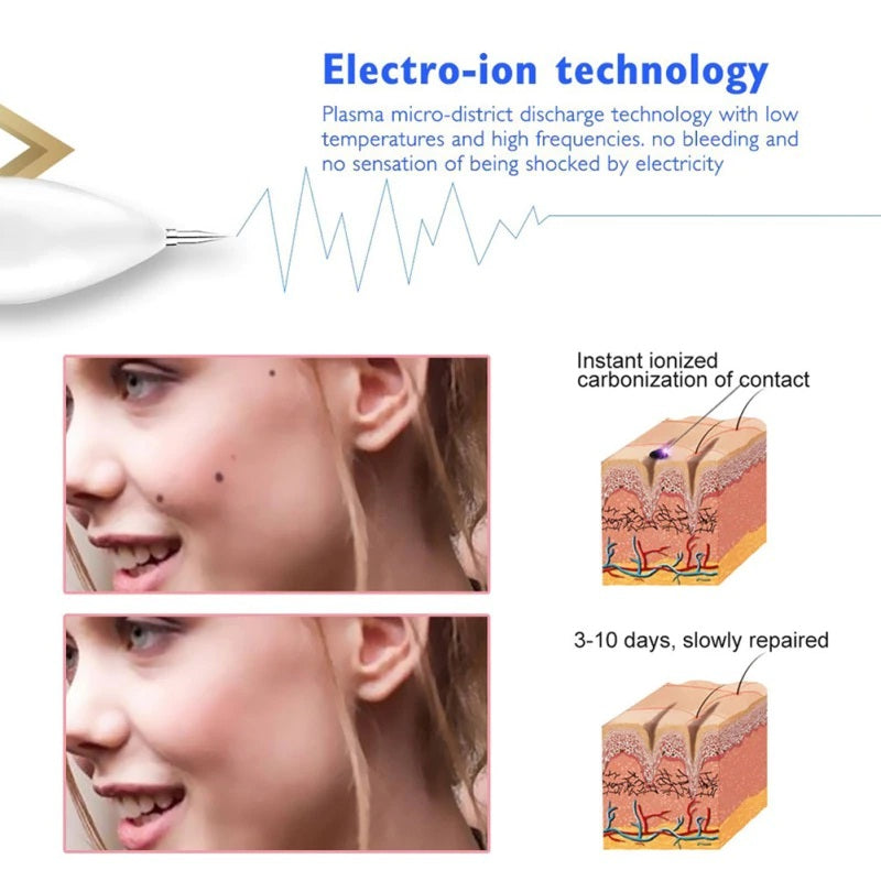 Mini Laser Freckle Skin Mole Dark Spot Remover Face Wart Tag Tattoo Removal Pen