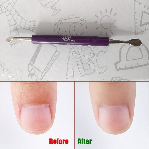 Stainless Steel Ingrown Finger & Toenail Cleaning and Cutting Tool – Dual-Ended Cuticle Pusher, Spoon Knife Gauge Nail Cleaner, Dead Skin Remover for Gel Polish, Manicure & Pedicure (Professional & Personal Use)